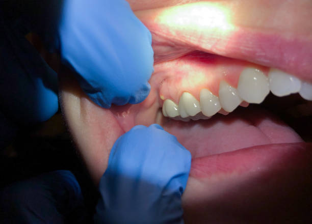 Best Emergency Dental Surgery in Atkins, AR