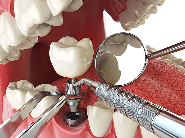 Best After-Hours Emergency Dentist in Atkins, AR